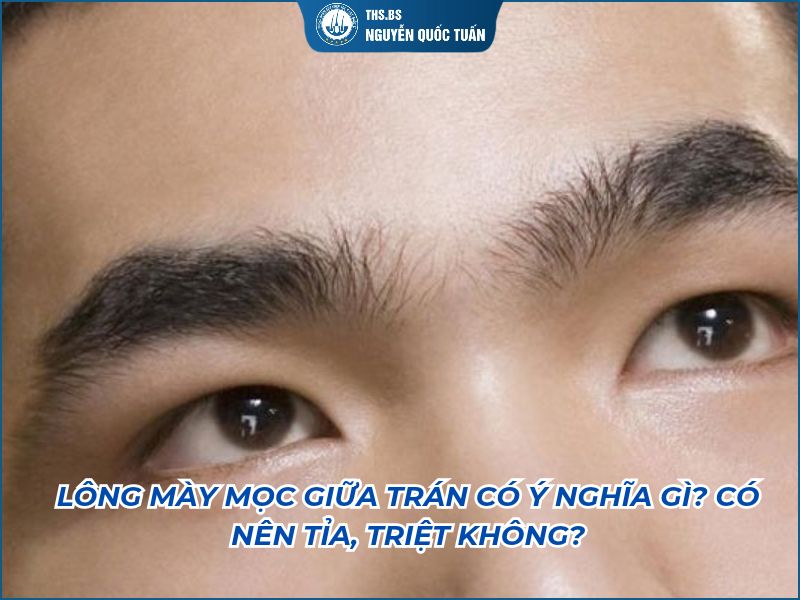 lông mày mọc giữa trán có ý nghĩa gì