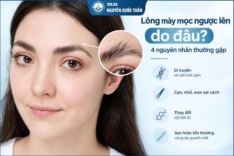 Lông mày mọc ngược lên do đâu? 4 nguyên nhân thường gặp