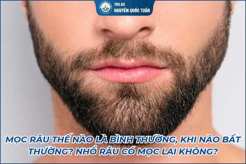 mọc râu thế nào là bình thường