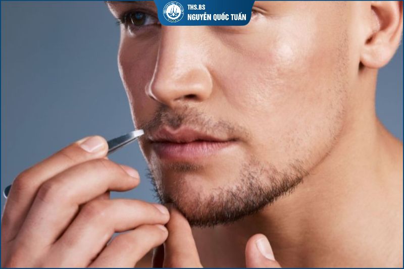 Nhổ râu có mọc lại không? Lưu ý cần biết trước khi nhổ 