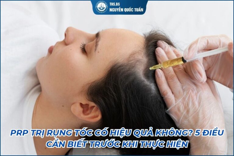 prp trị rụng tóc có hiệu quả không
