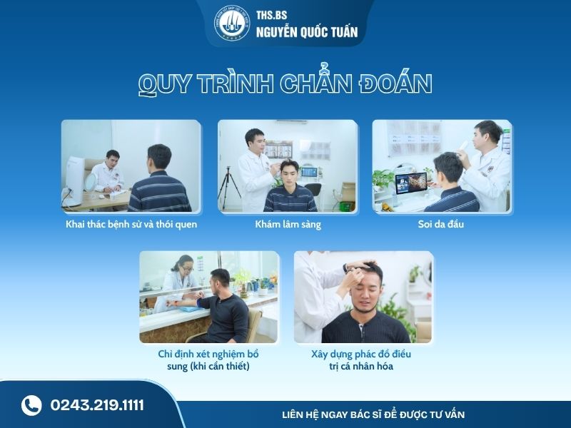 Quy trình chẩn đoán tình trạng nang tóc trước khi điều trị