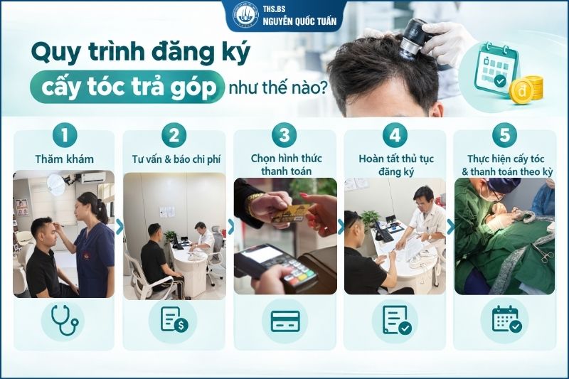 Quy trình đăng ký cấy tóc trả góp diễn ra như thế nào 