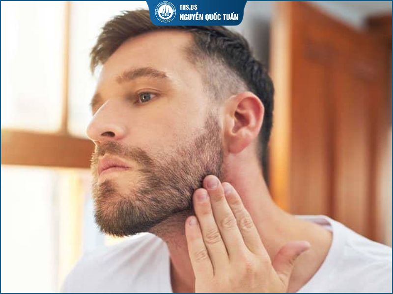 Râu mọc nhanh phải làm sao? 