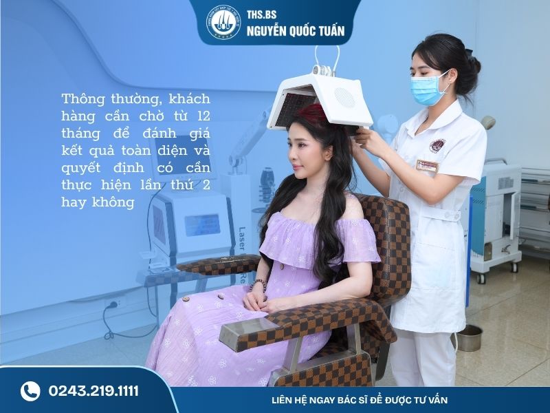 Sau cấy tóc bao lâu mới biết có cần thực hiện lần 2 