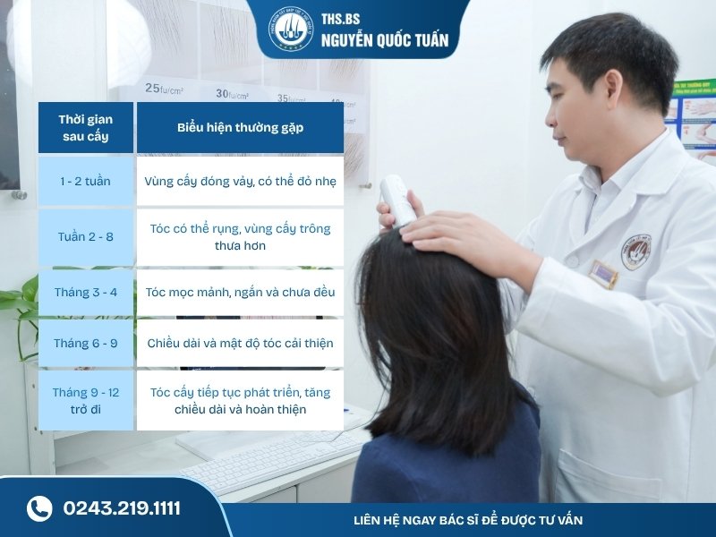 Sau cấy tóc bao lâu thì mọc lại? Lộ trình phát triển của tóc 