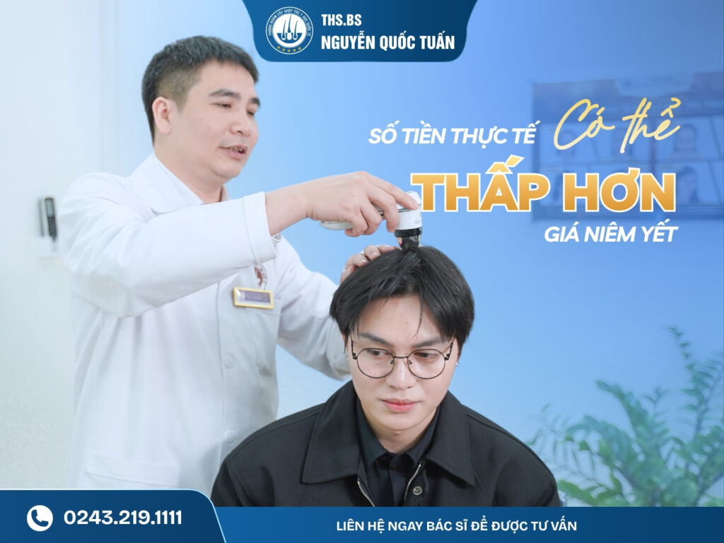 Cấy 2000 nang tóc bao nhiêu tiền? Bảng giá theo từng công nghệ