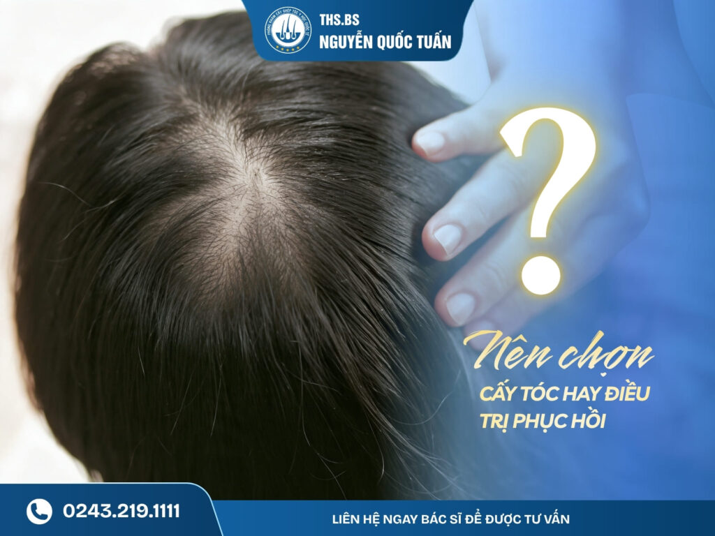 Người tóc mỏng yếu nên chọn cấy tóc hay điều trị phục hồi? 
