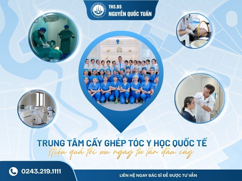 Trung tâm Cấy ghép tóc Y học Quốc tế - Hiệu quả tối ưu ngay từ lần đầu cấy