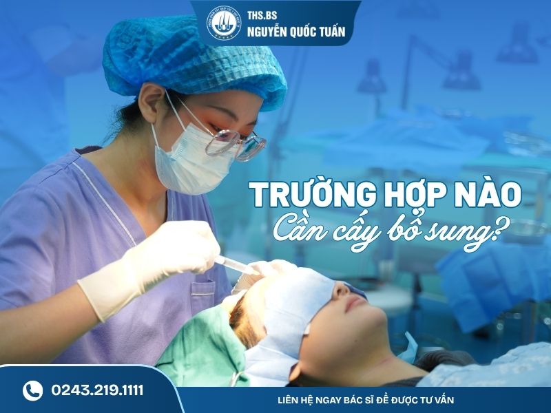 Trường hợp nào cần cấy bổ sung 