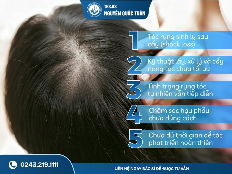 Những nguyên nhân phổ biến khiến tóc sau cấy vẫn thưa