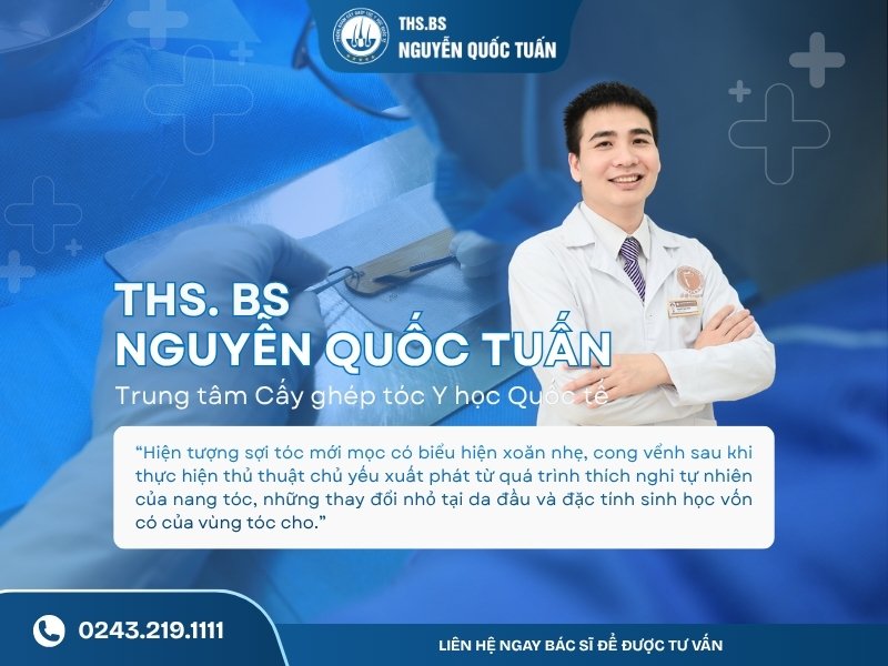 Vì sao tóc mới mọc bị xoăn sau cấy? 4 nguyên nhân thường gặp 