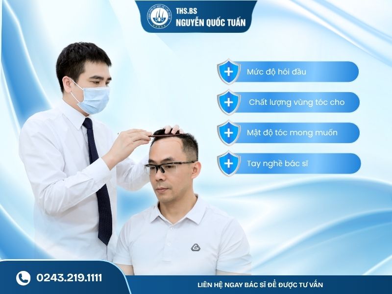 4 yếu tố quyết định số lần cấy tóc cần thực hiện 